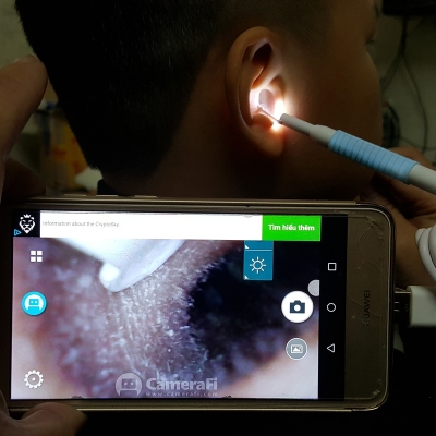 camera noi soi lay ray tai